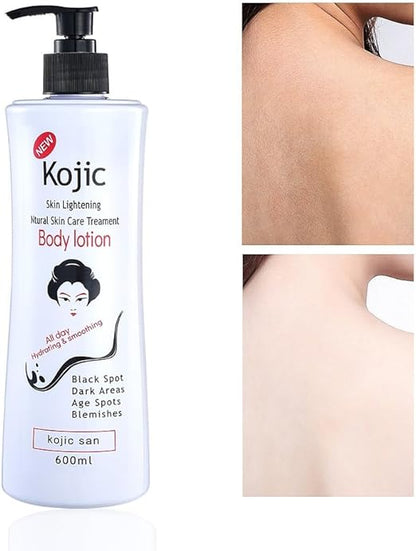 🌟🌿 Kojic Skin Lightening Body Lotion 🌿🌟