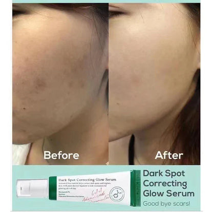 ✨Axis-Y Dark Spot Correcting Glow Serum - 50ml🌿💖