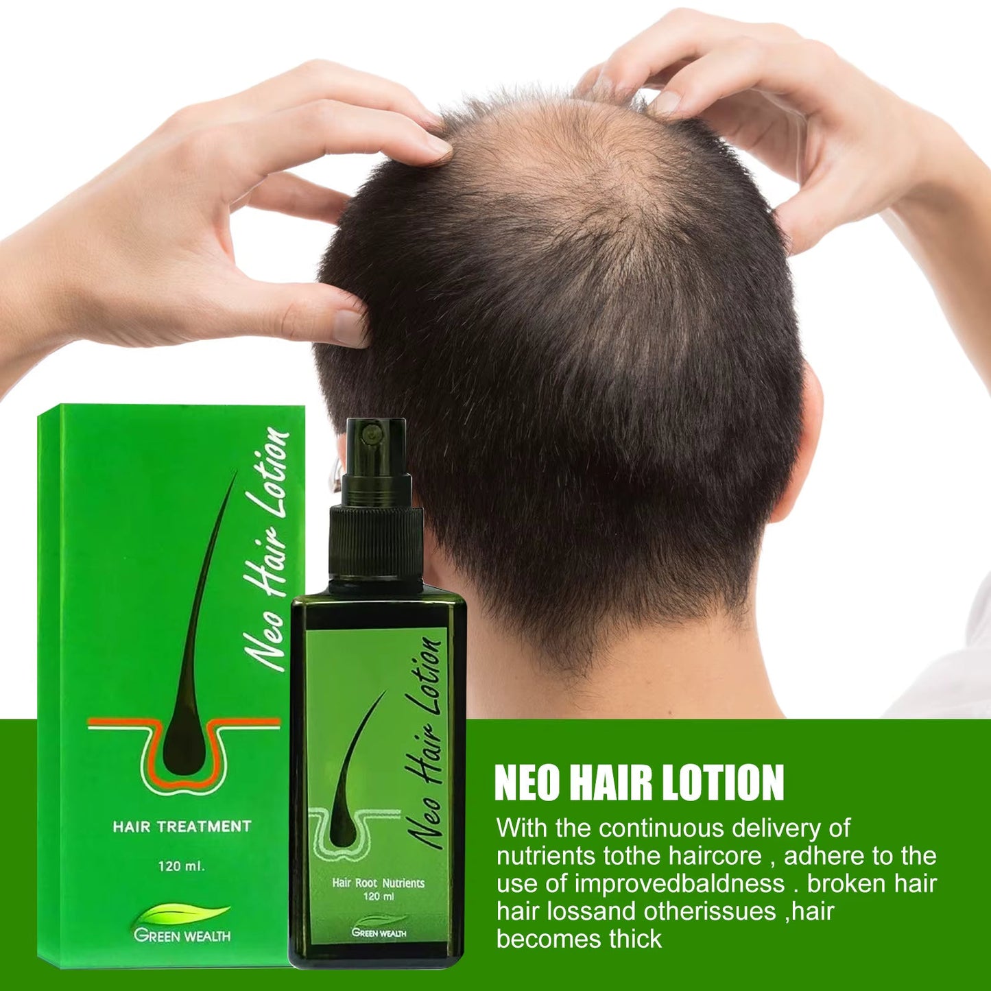 🌿 Neo Hair Lotion-Hair Regrowth 🌿