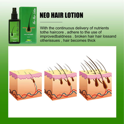 🌿 Neo Hair Lotion-Hair Regrowth 🌿