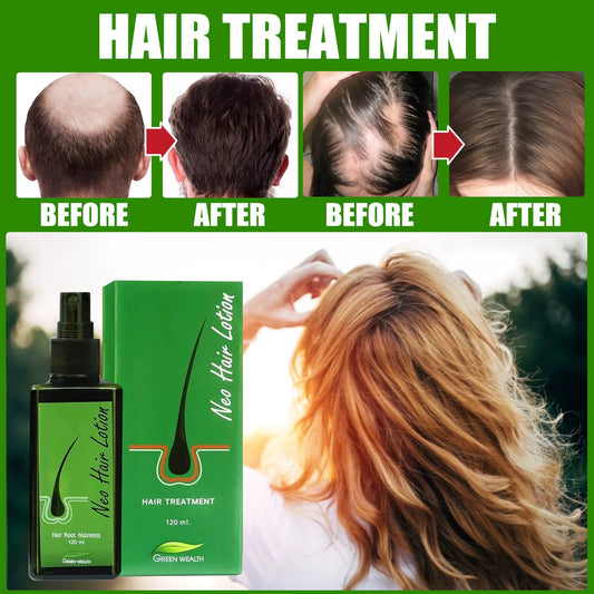 🌿 Neo Hair Lotion-Hair Regrowth 🌿