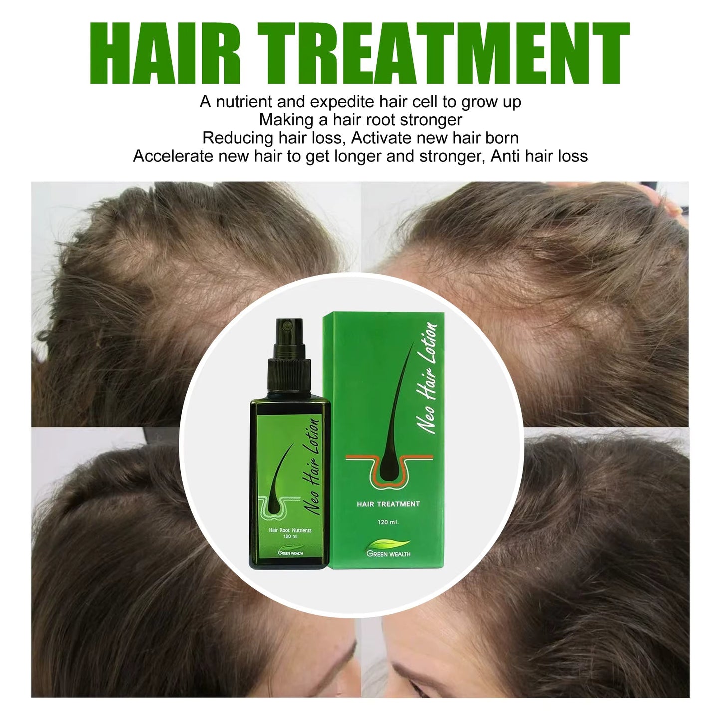 🌿 Neo Hair Lotion-Hair Regrowth 🌿