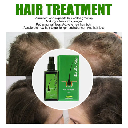 🌿 Neo Hair Lotion-Hair Regrowth 🌿