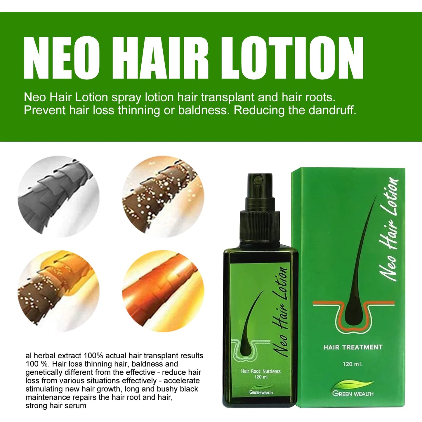 🌿 Neo Hair Lotion-Hair Regrowth 🌿