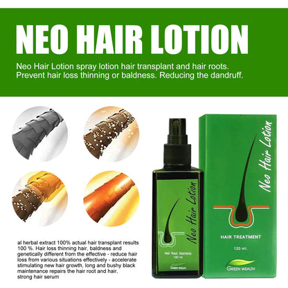 🌿 Neo Hair Lotion-Hair Regrowth 🌿