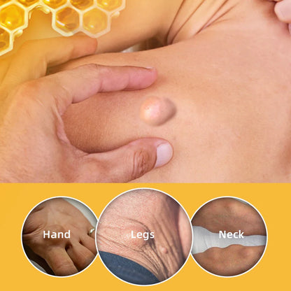 🐝✨ Sumifun Bee Venom Lipoma Cream – Transform Your Skin, Naturally! ✨🐝