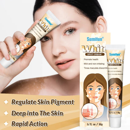 🌟 Sumifun Vitiligo Treatment Cream – Restore Your Skin’s Natural Beauty! 🌟