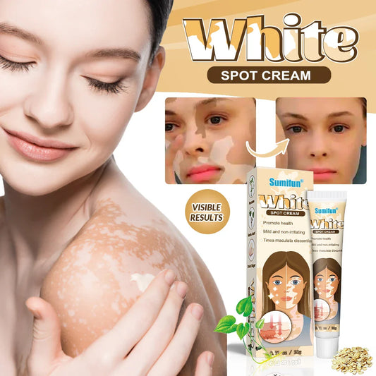 🌟 Sumifun Vitiligo Treatment Cream – Restore Your Skin’s Natural Beauty! 🌟