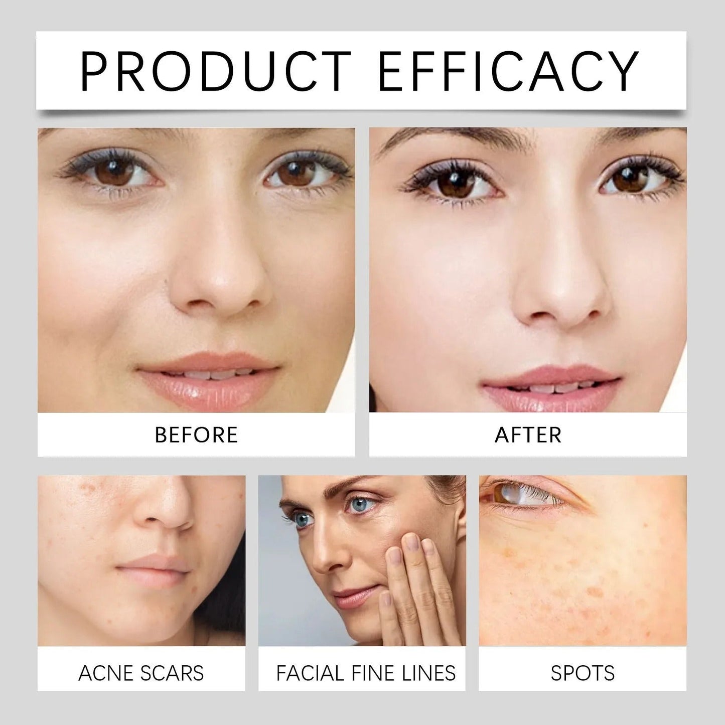 Aobenz Dark Spot Serum Remover