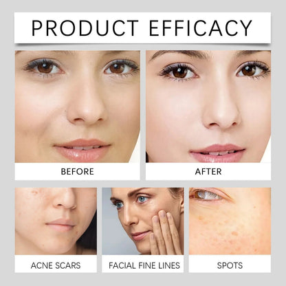 Aobenz Dark Spot Serum Remover