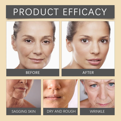 🐝💎 Botox Bee Venom Wrinkle Removal Cream 💎🐝