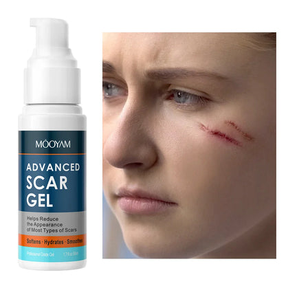 🌿 Scar Gel Body & Caesarean Section Scar Gel ✨